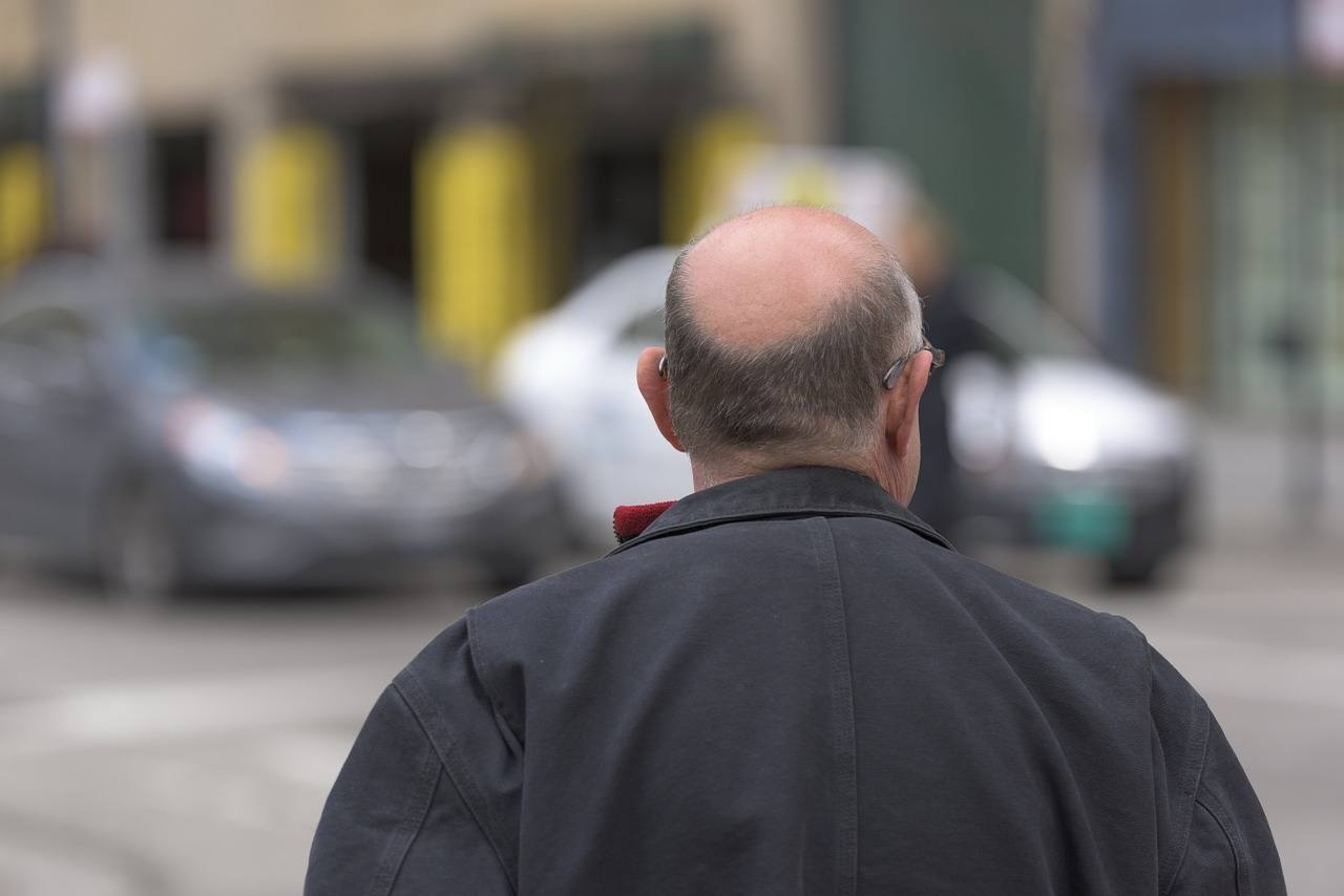 la perte des cheveux, comment y remédier ?