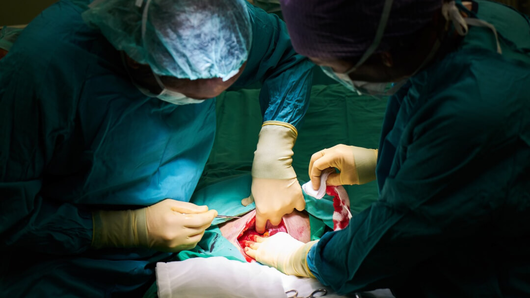 une rhinoplastie effectuée par un grand chirurgien pour nous sentir mieux